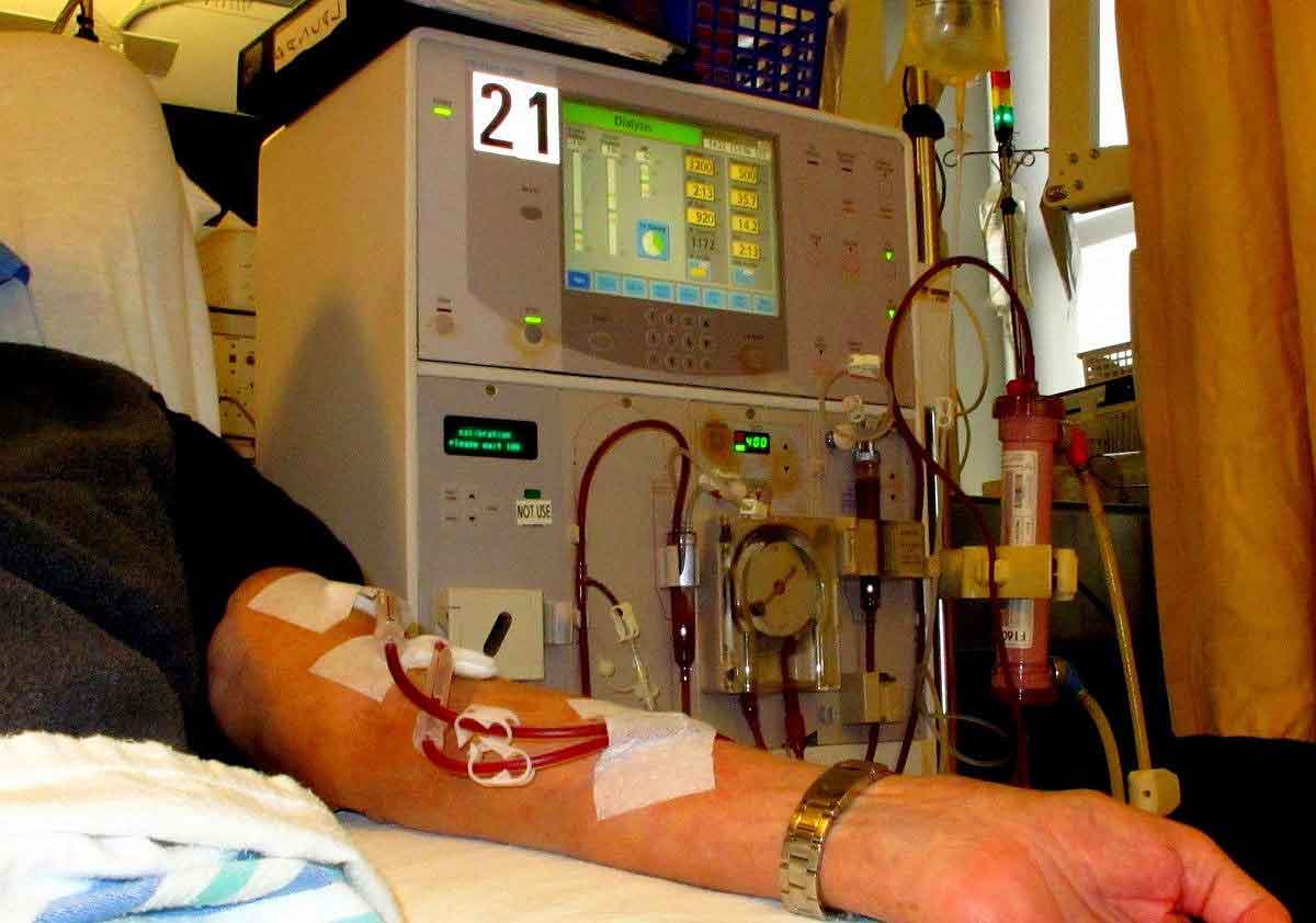 Patient on Dialysis